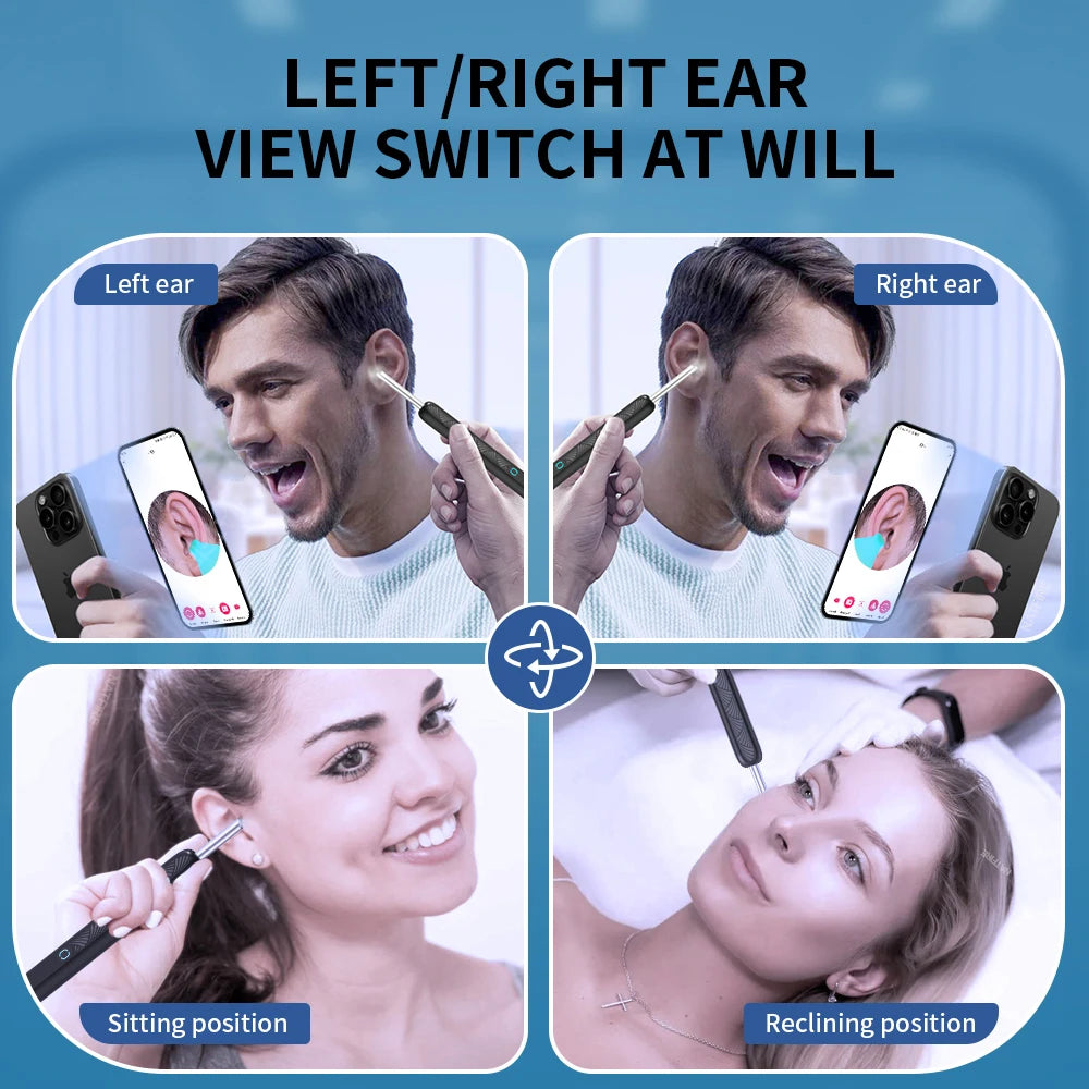 THE VIRAL DEPARTMENT™ EAR SCOPE